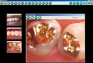 Intra oral imaging | The Emergency Dentist Phoenix