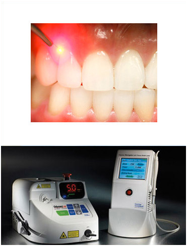 Laser Gum Recontouring | The Emergency Dentist Phoenix